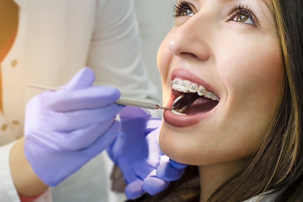Braces Near Me: Tips To Help Prepare For Treatment