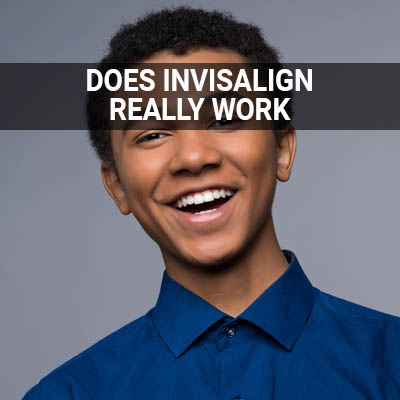 Navigation image for our Does Invisalign Really Work page