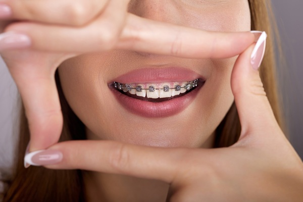 Visit A Kids Orthodontist To Enhance Young Smiles
