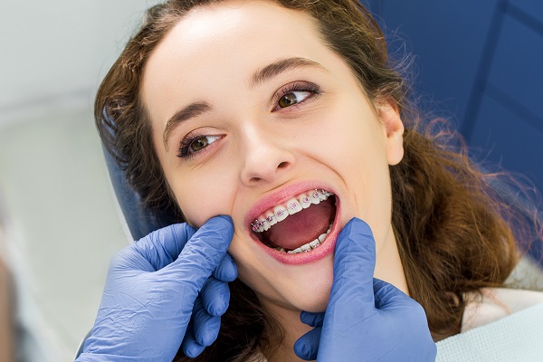 Common Teeth Straightening Options From An Orthodontist
